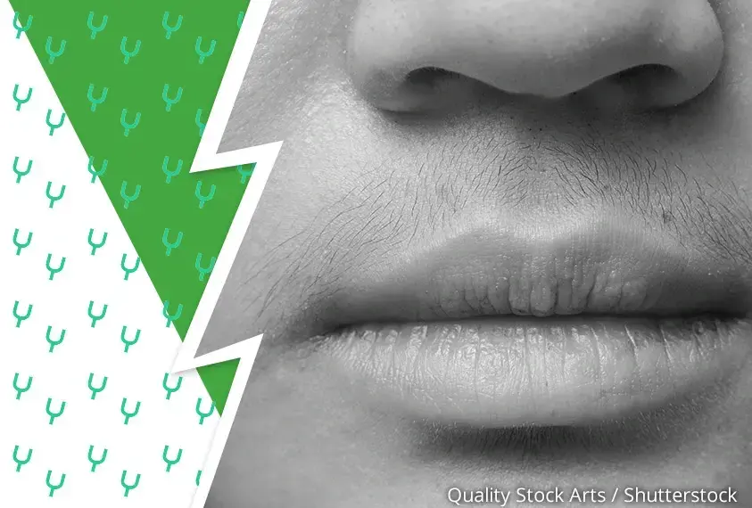 Flaum &uuml;ber der Oberlippe