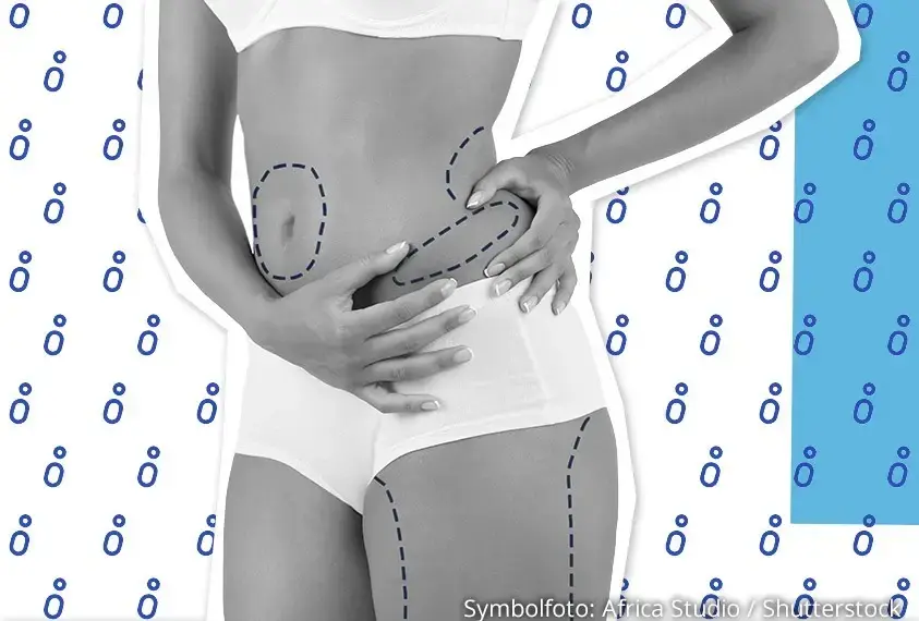 K&ouml;rper mit Markierungen