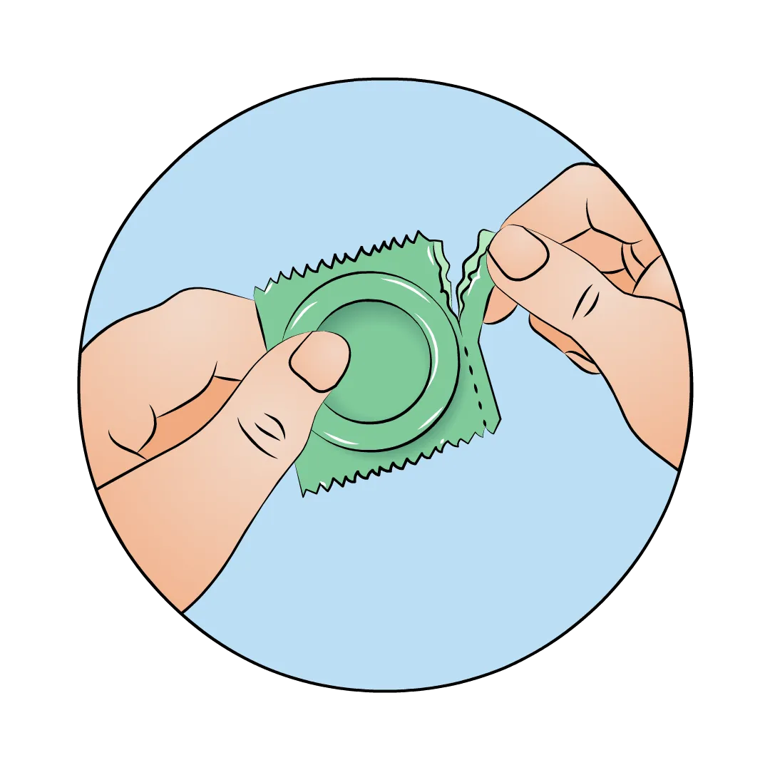 Illustration: Kondompackung aufrei&szlig;en