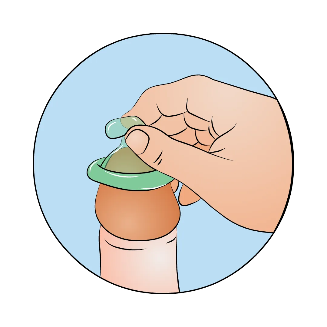 Illustration: Kondom aufsetzen