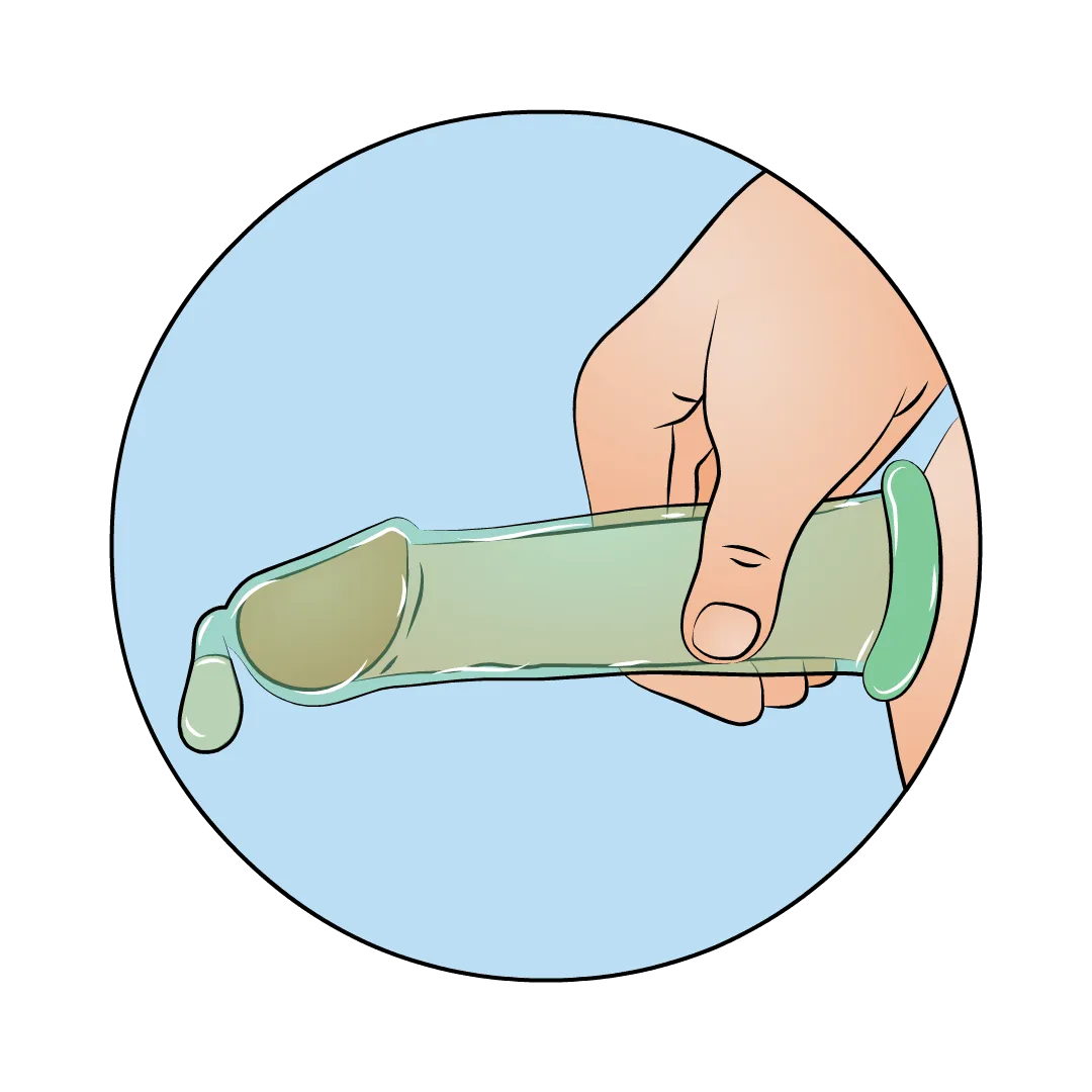 Illustration: Reservoir mit Samenfl&uuml;ssigkeit