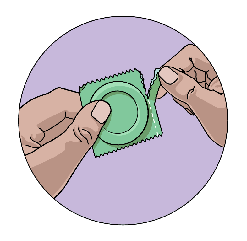 Illustration: Kondompackung aufreißen