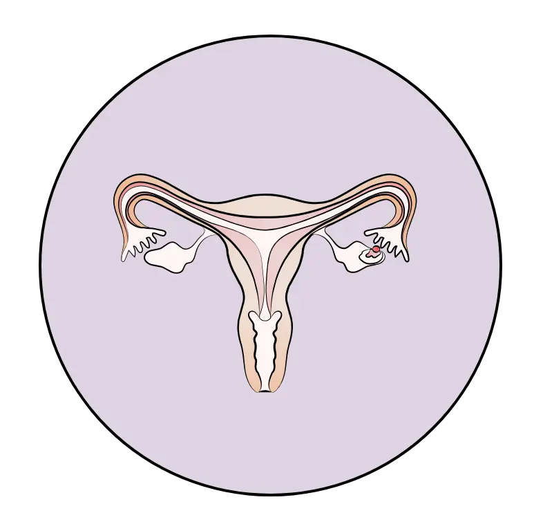 Illustration: Querschnitt einer Geb&auml;rmutter zum Zeitpunkt des Eisprungs.