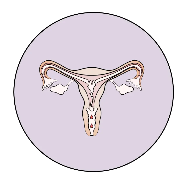 Illustration: Querschnitt einer Geb&auml;rmutter zum Zeitpunkt der Eiwanderung.