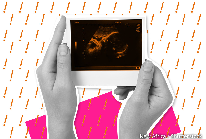 Ultraschallbild einer Schwangerschaft